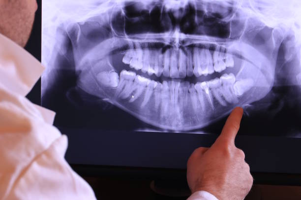 Best Walk-In Emergency Dentist in Llington, MI